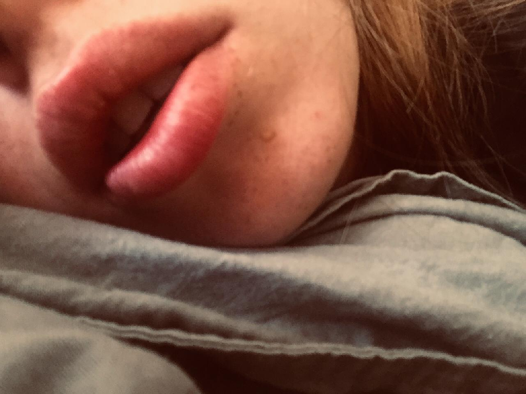 Lips