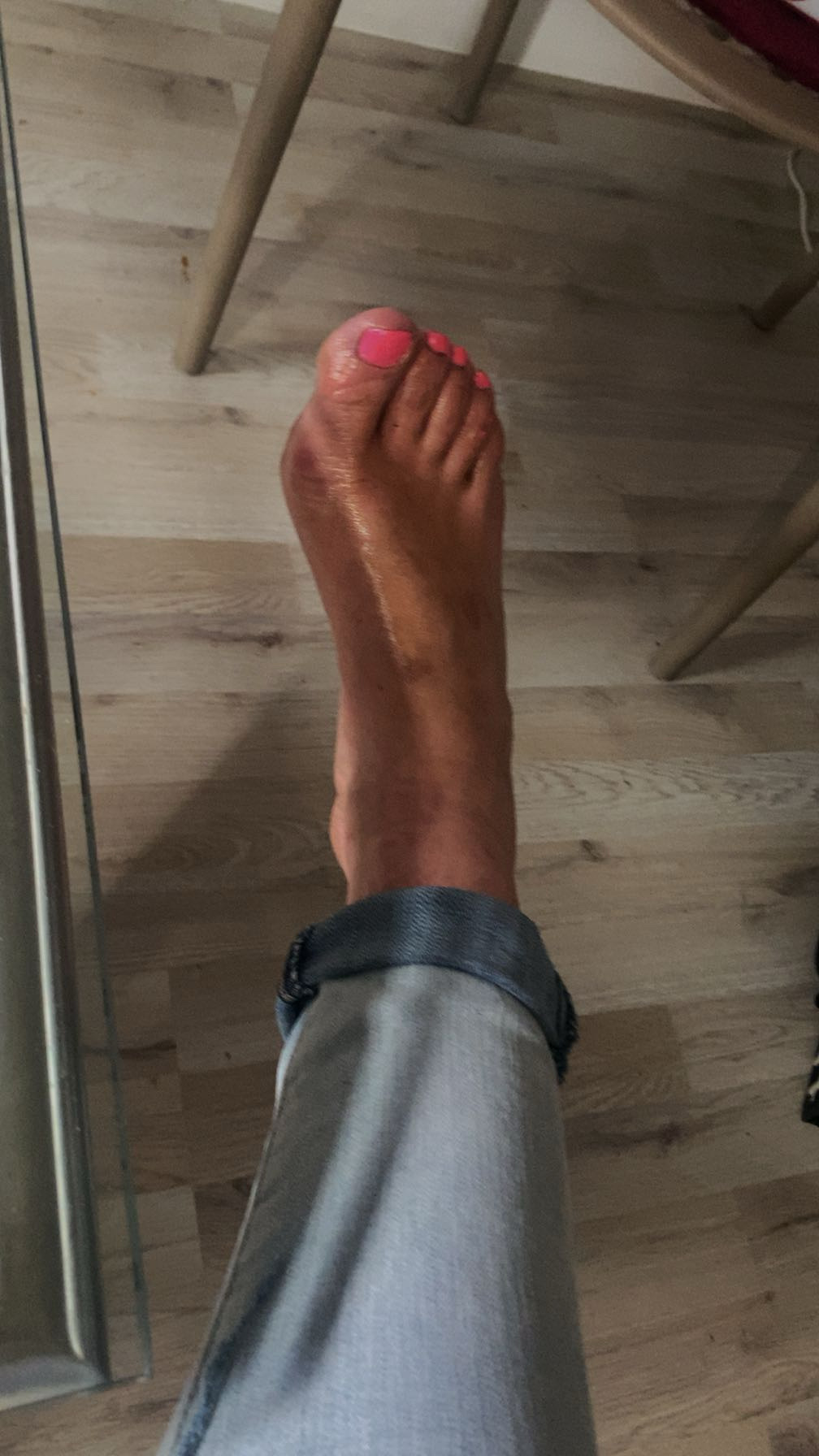 Kinky feet